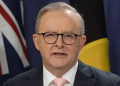 Anthony Albanese