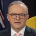 Anthony Albanese