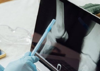 Bone Cancer