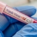 Nipah positive