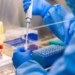 Ebola